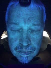 Máy chẩn đoán máy quét da, Phân tích da 3d Uv