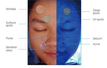 Máy phân tích da thông minh công suất 45W PDF In cho Doctor Beauty Salon