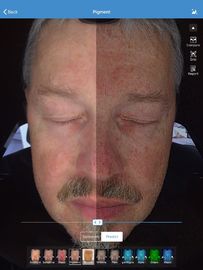 Máy phân tích da mặt 3d Máy quét Visia 32gb Lưu trữ cho Bác sĩ Skin Clinic