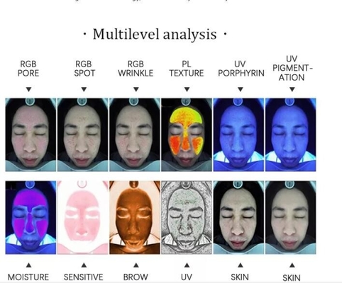 RGB UV PL Android Professional Skin Analyzer Máy ảnh 15MP trên khuôn mặt