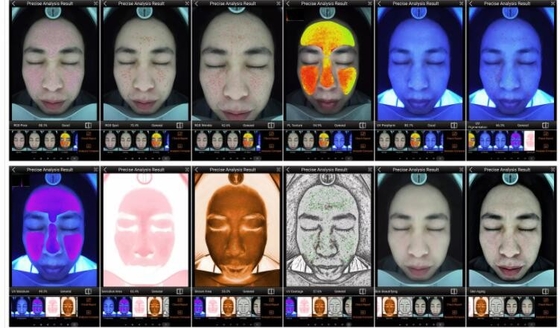 Máy phân tích da thông minh RGB UV PL